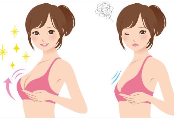 做完假体隆胸后抬手臂或一用力假体就往上跑什么原因?