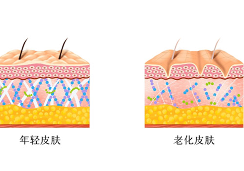 热玛吉四代和五代哪个成果好