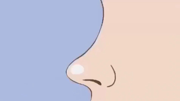 肋骨鼻多久修复自然