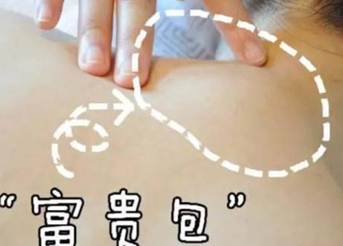 富贵包的影响因素