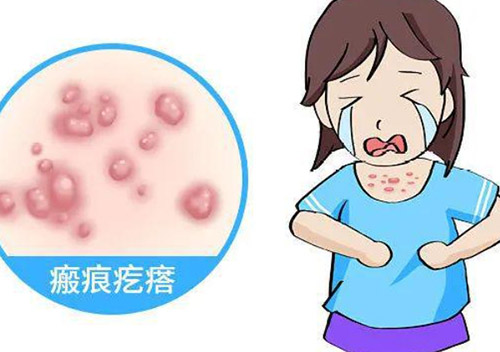 疤痕疙瘩图片
