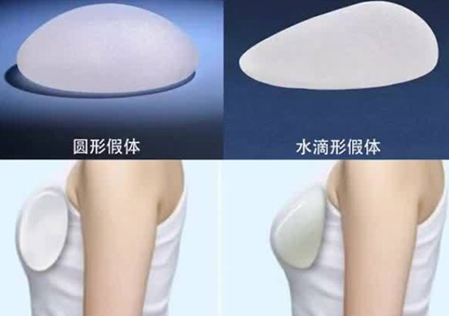 德国宝俪假体水滴型和圆形的区别