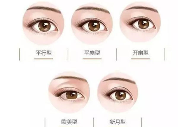 双眼皮