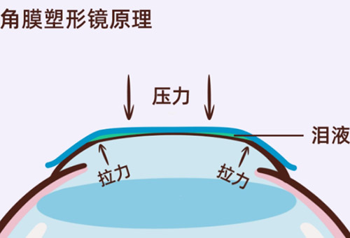 ok镜原理
