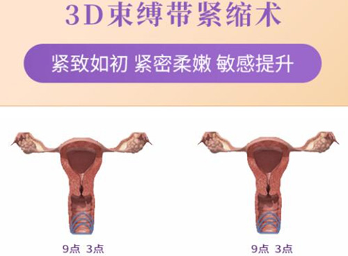 3D私密生物束带术原理