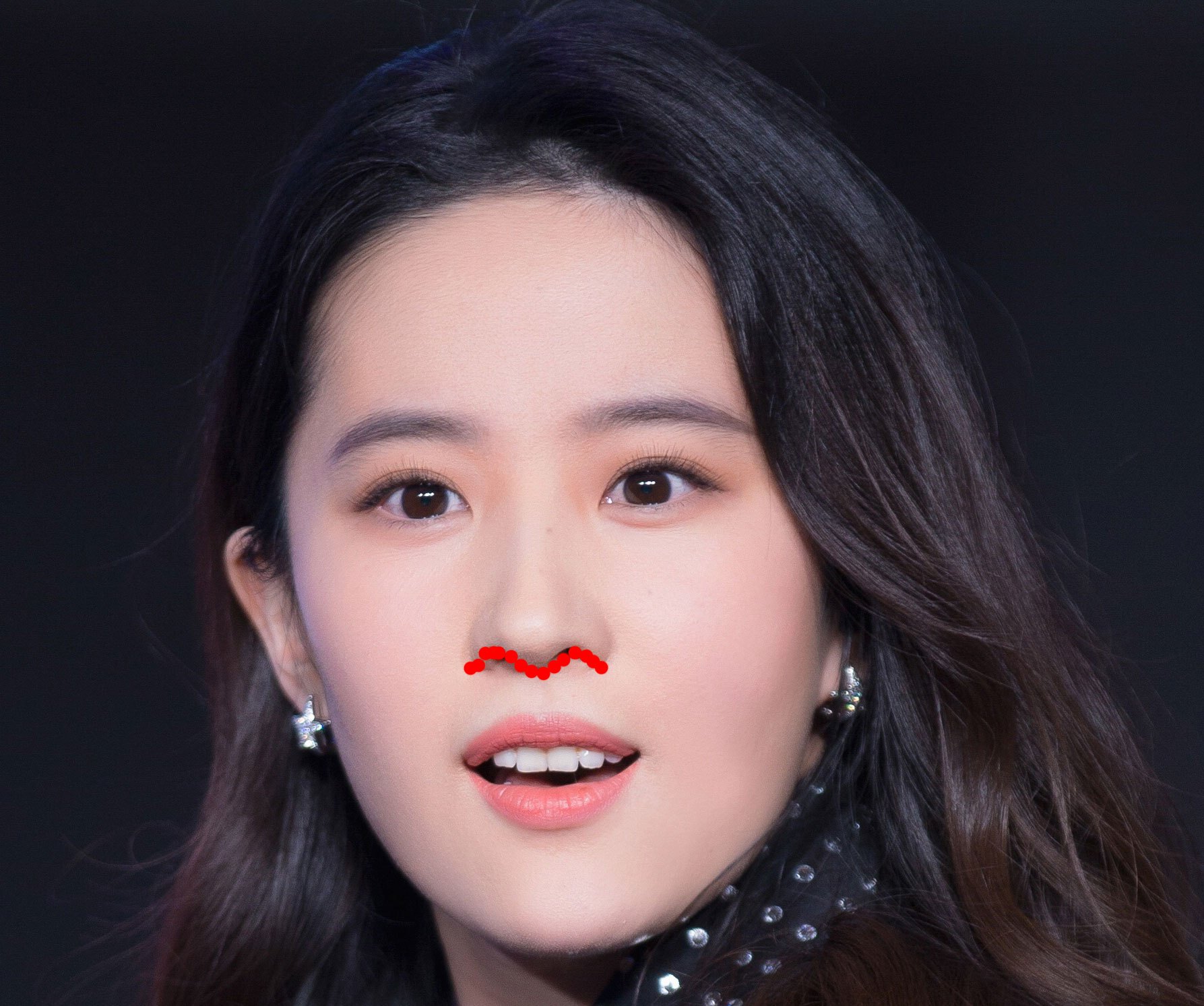 假体丰胸之后会有剧烈的疼痛吗？(假体隆胸和这个自体脂肪隆胸具体哪个好)