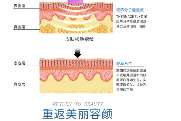 做热拉提需要注意什么?