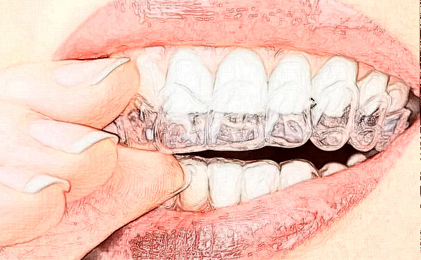 苏州康美牙齿矫正医生推荐?哪个医生好?