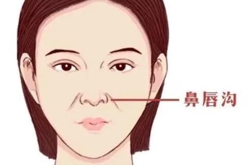 有哪些因素影响玻尿酸填充鼻唇沟的价格?