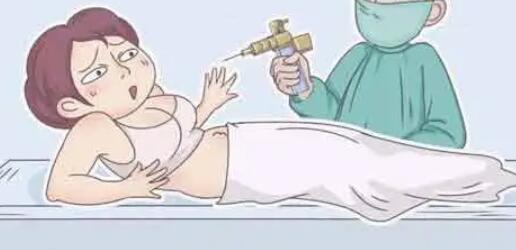小腿吸脂动漫02.jpg