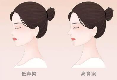 郑在祐做鼻子怎么样？综合实力、擅长项目、技术口碑分析