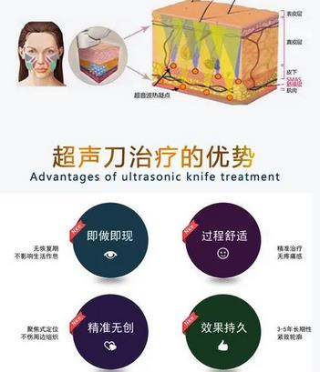 超声刀没有成果吗?