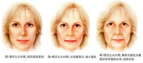 韩式除皱手术的特点有哪些？