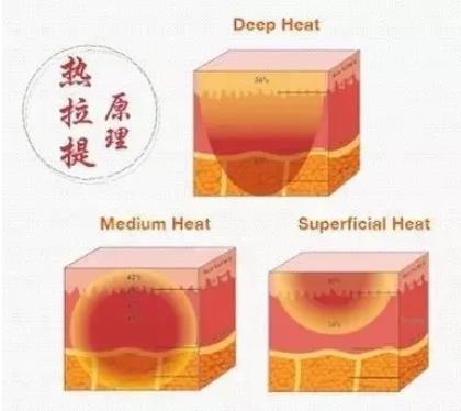 什么是热拉提?有什么原理