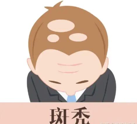 斑秃较好的治疗方法有哪些？这几点小技巧你得学起来，重获浓密秀发~