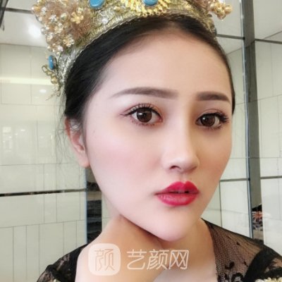 武汉莱恩医疗美容门诊部正规吗？点阵激光靠谱吗？2022实例曝光