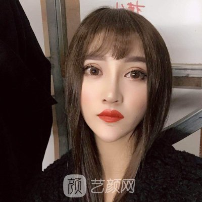 武汉莱恩医疗美容门诊部正规吗？点阵激光靠谱吗？2022实例曝光