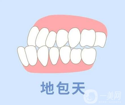 地包天术后有哪些注意事项？
