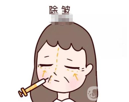 眉间纹该如何进行治疗？