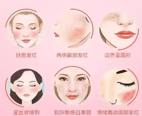 激光去除红血丝安好吗？有哪些注意事项?
