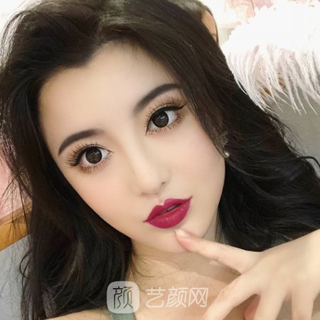 苏州美莱整形医院毛发种植实例公布｜附亲测体验成果图
