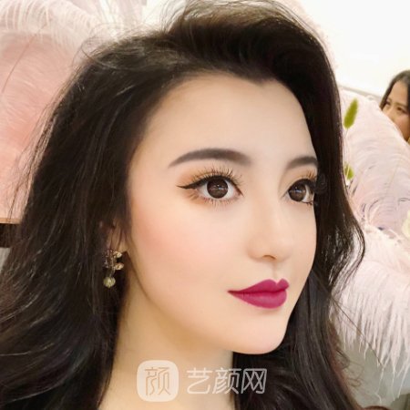 苏州美莱整形医院毛发种植实例公布｜附亲测体验成果图