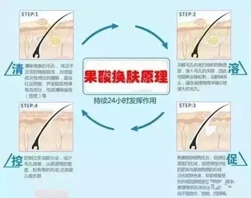 果酸换肤能去除黑头吗？可以维持多长时间?
