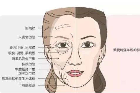 法令纹和鼻基底的区别是什么?