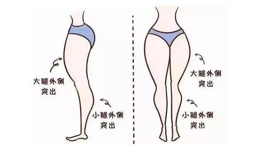 为什么吸脂后越来越胖了?术后要注意这些问题