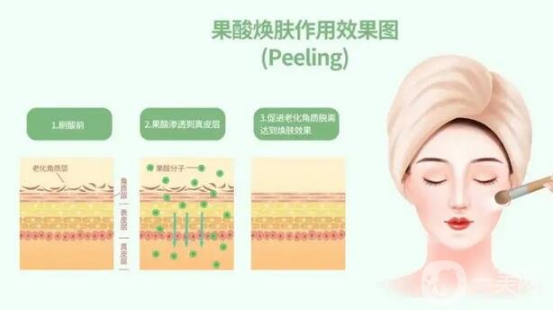 果酸换肤有哪些适用范围？适合哪些人？