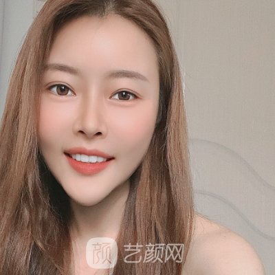 深圳欢乐口腔医院怎么样？牙齿正畸实例及成果图出炉