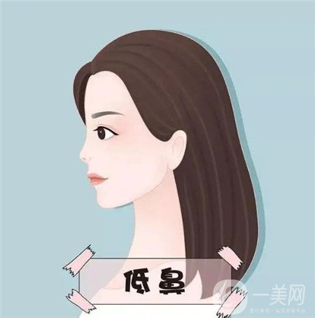 上海华美医疗美容医院怎么样？正规吗？供2021价格表+隆鼻实例参考