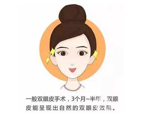 邯郸三院双眼皮做得好吗？整形价格表及实例分享
