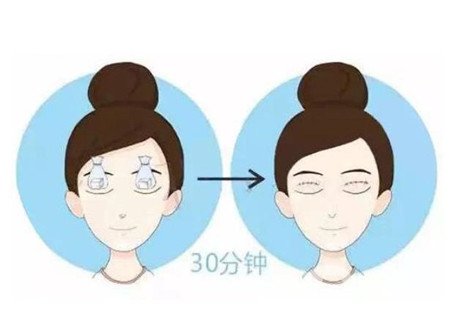 邯郸三院双眼皮做得好吗？整形价格表及实例分享