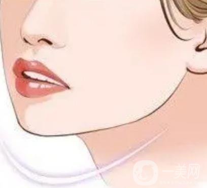 面部吸脂疼吗?成果是长期性的吗？面部吸脂会不会反弹？