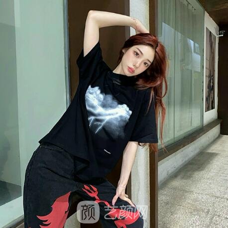 昆明德尔美客医疗美容门诊部除皱实例出炉｜成果自然美观