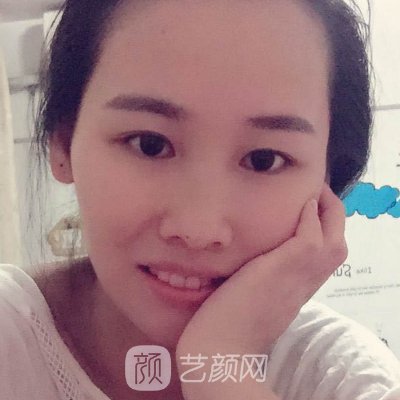 深圳柏伦口腔门诊部怎么样？全新种植牙实例出炉