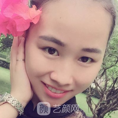 深圳柏伦口腔门诊部怎么样？全新种植牙实例出炉