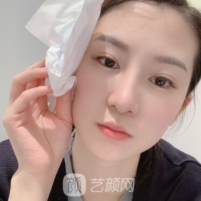 石家庄黛芙瘦脸除皱实例公开|内附体验成果图