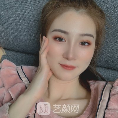 石家庄黛芙瘦脸除皱实例公开|内附体验成果图