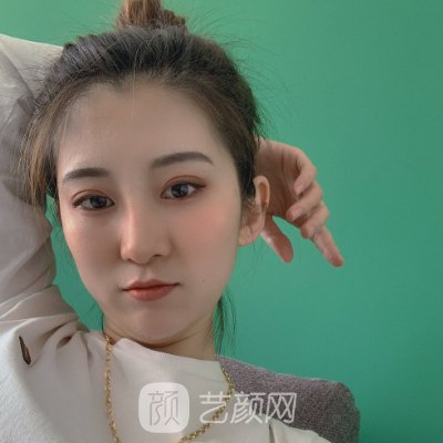 石家庄黛芙瘦脸除皱实例公开|内附体验成果图