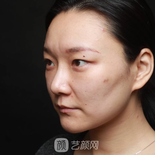 深圳嘉美医疗美容门诊部面部提升靠谱吗?全新体验实例一览