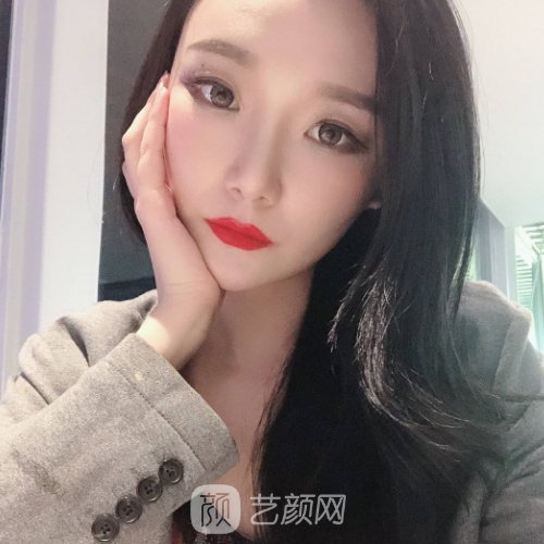 深圳嘉美医疗美容门诊部面部提升靠谱吗?全新体验实例一览