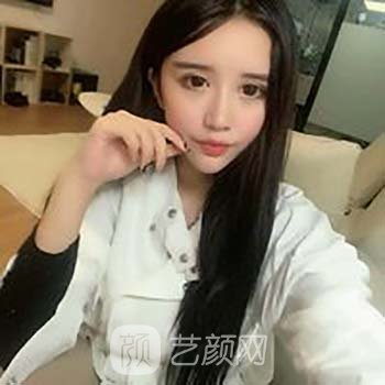 谢红权做的脂肪填充怎么样？医生简介+脂肪填充面部实例