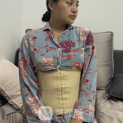 厦门欧菲吸脂靠谱吗？全新实例及成果图展示