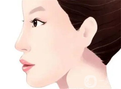 湖南省人民医院整形美容科隆鼻*果如何？看价格表及实例实述