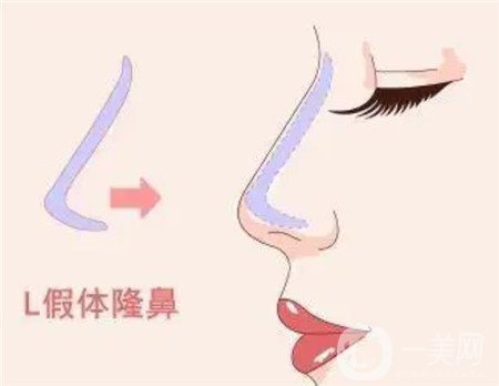 郑州东方整形医院怎么样？供价格表+实例参考