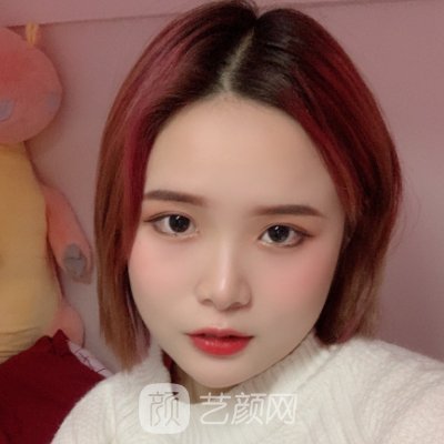 长春卓研整形医院怎么样？面部除皱实例及成果图出炉