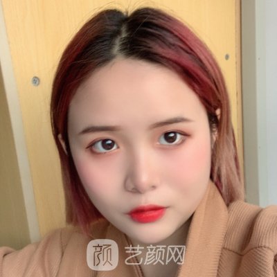 长春卓研整形医院怎么样？面部除皱实例及成果图出炉