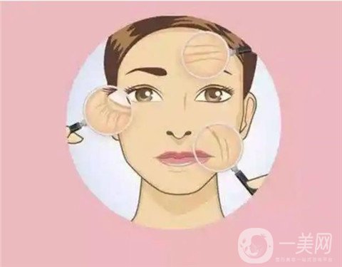 面部埋线有哪些副作用？适合什么人？